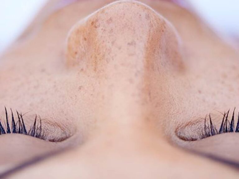 Home Laser Light Skin Clinic