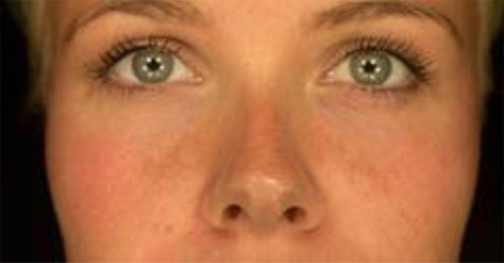 Skin analysis consultation