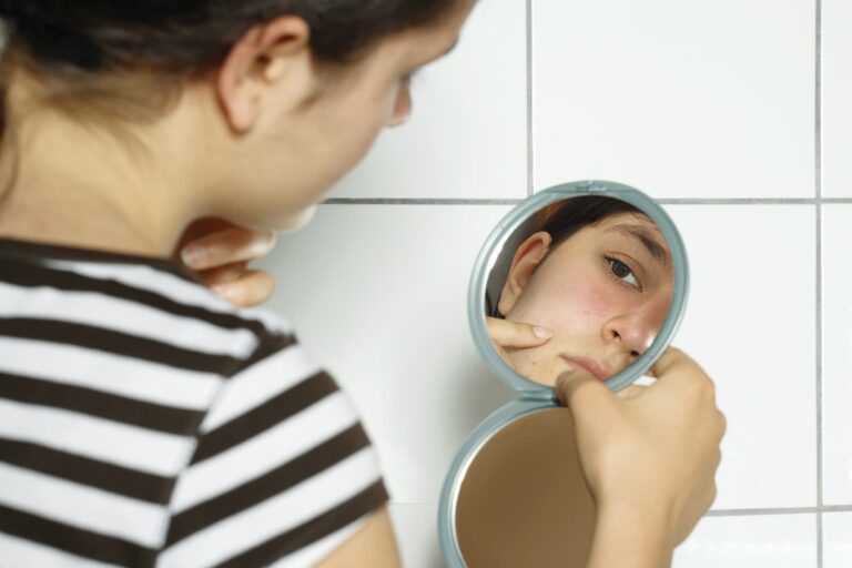 acne treatments dagenham - female holding a mirror
