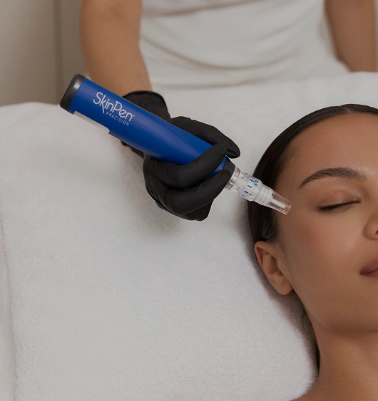 Skin Pen Microneedling